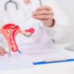 All About Pap Smears and Their Role in Identifying Cervical Cancer